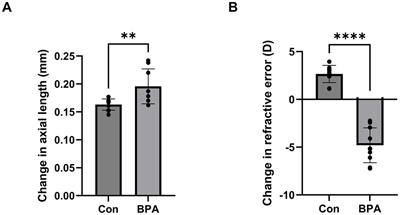 Bisphenol A exposure triggers endoplasmic reticulum stress pathway leading to ocular axial elongation in mice